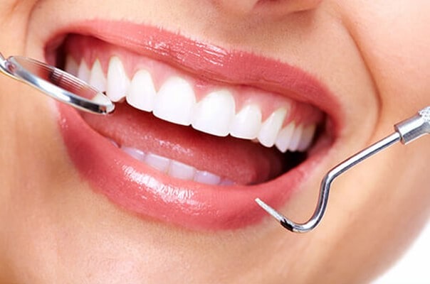 اسکیلینگ دندان هر چندوقت یکبار باید انجام‌شود؟