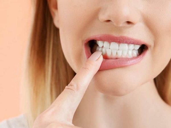 چه زماني بايد نگران خونريزی لثه شويم؟