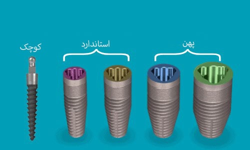 اندازه ایمپلنت