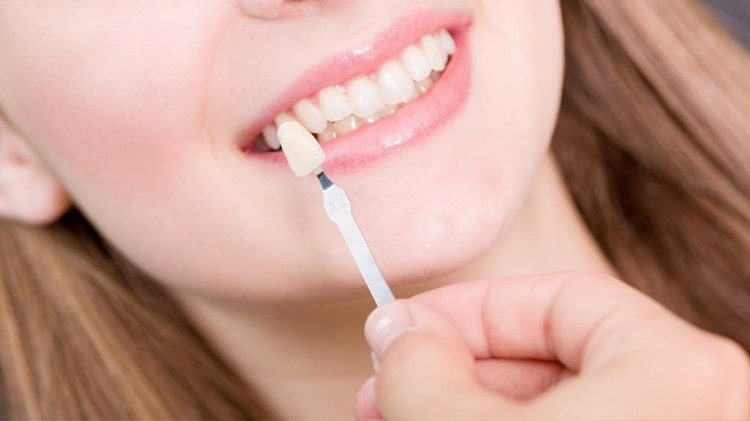 ماندگاری کامپوزیت ونیر