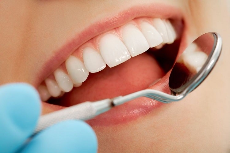 مراقبت از لمینت متحرک