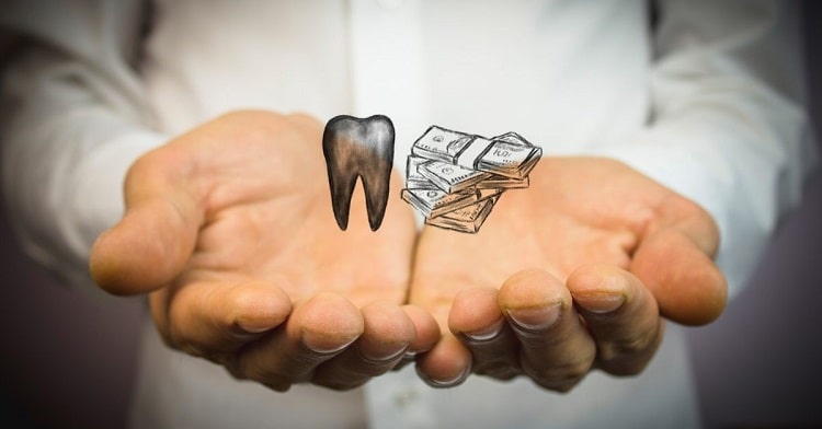 هزینه کاشت دندان