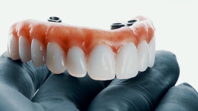 پروتز دندان ثابت و متحرک: انواع و مراحل ساخت 6 پروتزهای هیبریدی