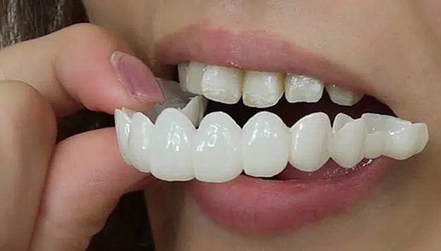 کاندیدهای استفاده از لمینت متحرک
