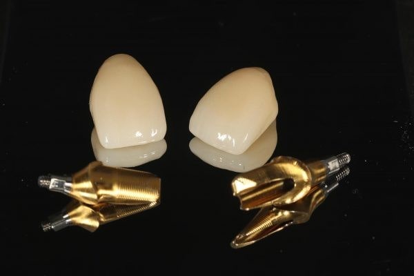 روکش ایمپلنت چسبی