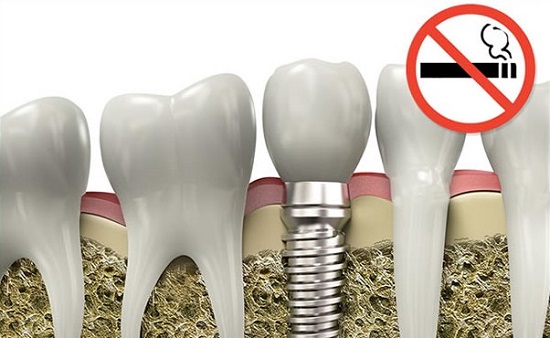 سیگار کشیدن