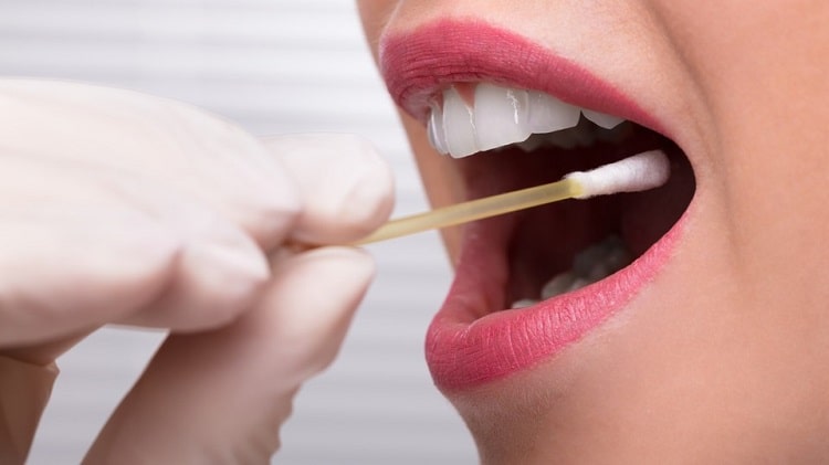 علائم سنگ لوزه، خطرات و راههای درمان آن 4 برداشتن سنگ لوزه با استفاده از گوش پاک کن