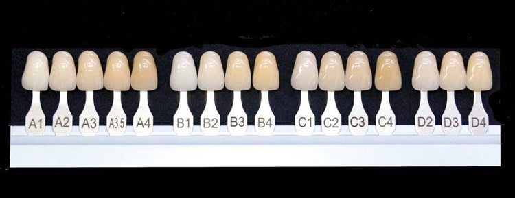 سایر نکات مهم برای انتخاب رنگ کامپوزیت دندان